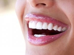 Dental Veneers in West Orange & Short Hills NJ