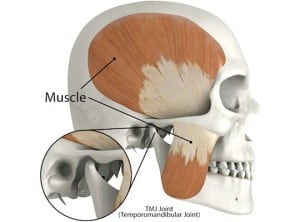 TMJ disorder West Orange NJ