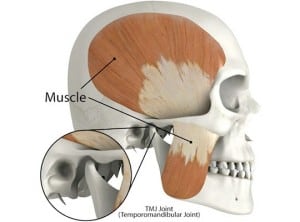 TMJ disorder at Northfield Dental Group in West Orange, NJ