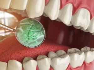 Gum disease myths