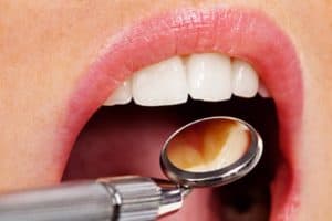 Treating common dental symptoms West Orange, NJ