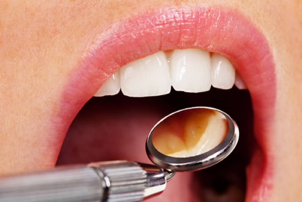 Top Dental Symptoms and What To Do About Them Northfield Dental Group