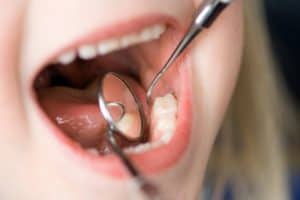 Top myths about oral health