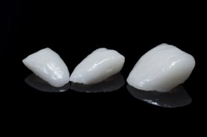 The versatility of porcelain veneers