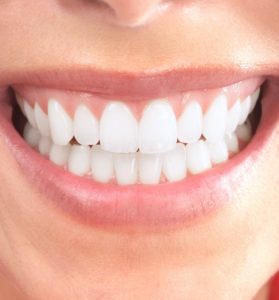 Tooth whitening in West Orange, NJ