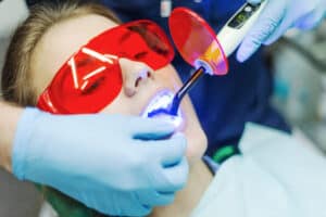 Laser Dentistry West Orange, NJ