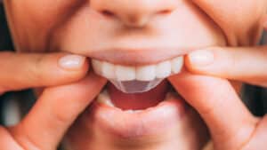 Teeth Whitening West Orange NJ