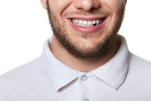 Dental Implant West Orange NJ