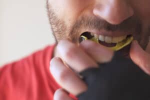 Sports Dentistry Mouthguard in West Orange
